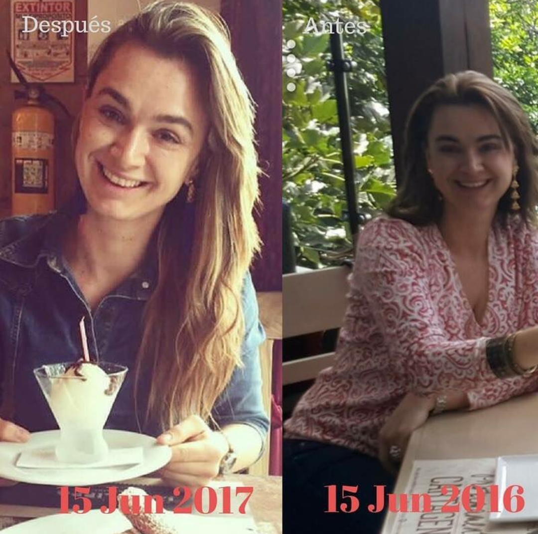 Caja de sachets Pre-Embarazo