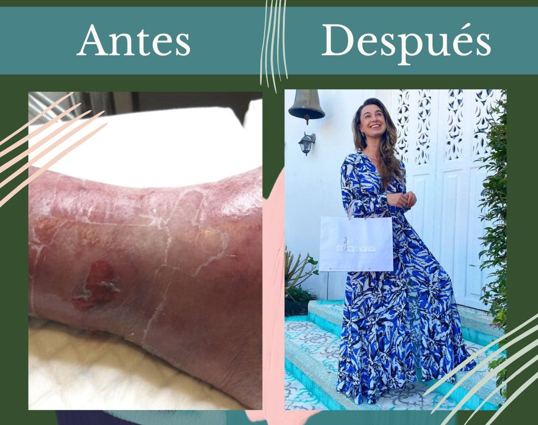 Milamores cambio mi vida