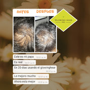 Tratamiento Capilar GlowingHair