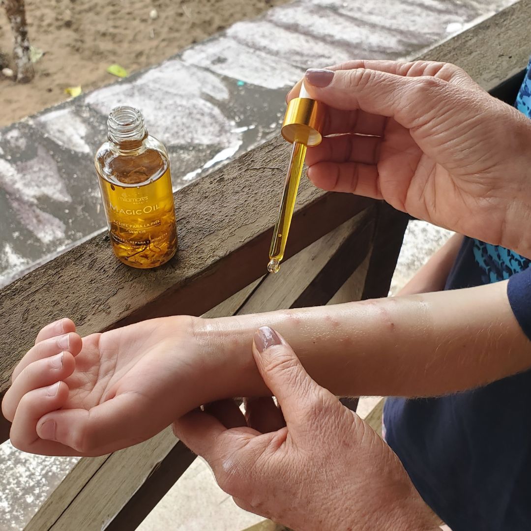 Magicoil remedio natural parea niños