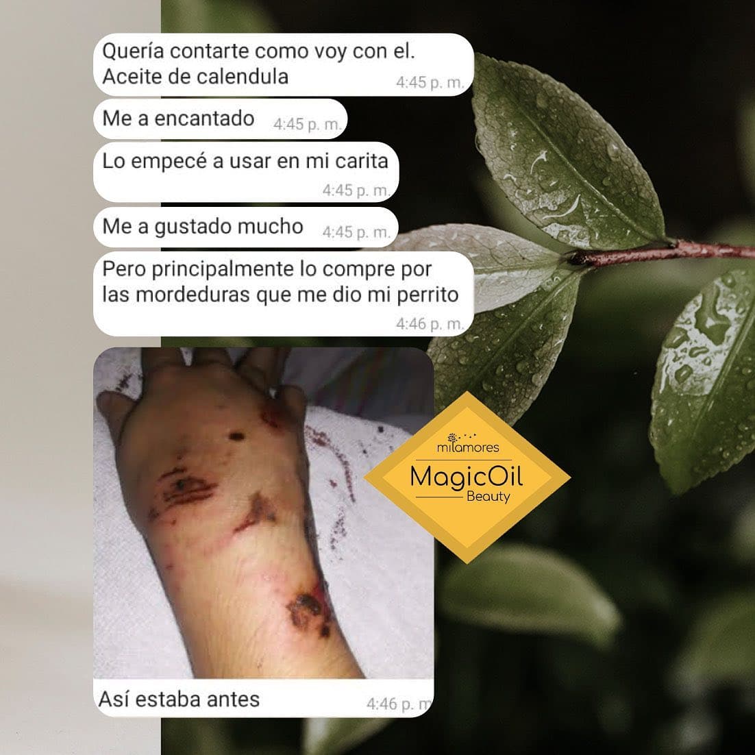 Testimonio MagicOil mordida de perro el antes