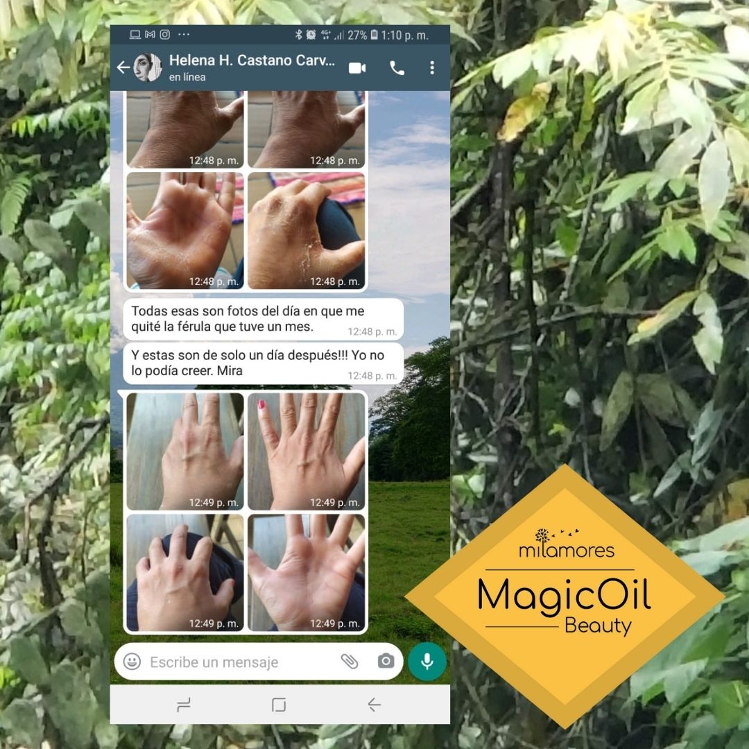 La Medica Helena Castaño nos comparte su testimonio con el MagicOil