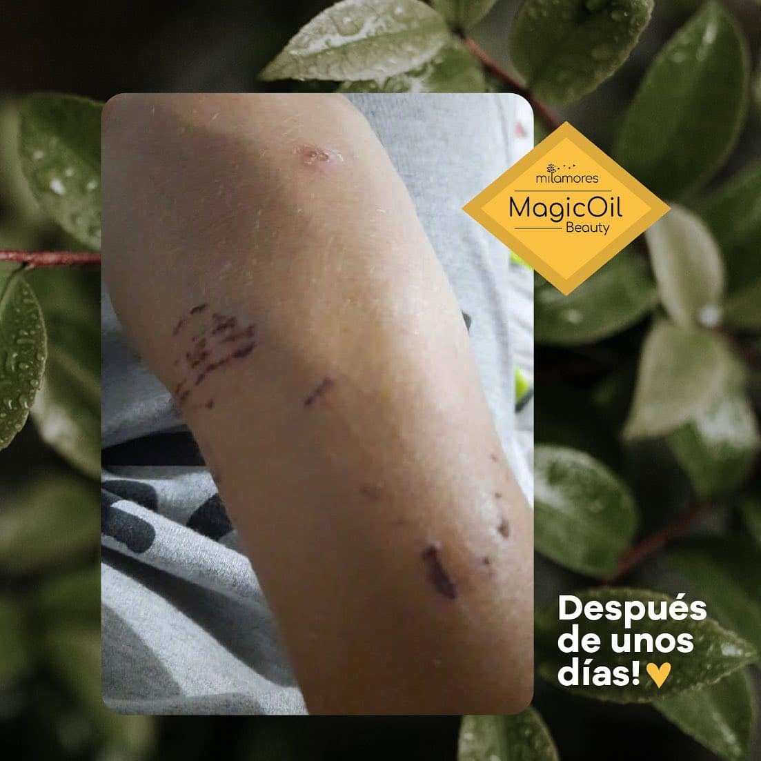 días despues testimonio magicoil